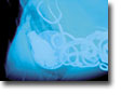 X-ray of ball in dog's stomach
